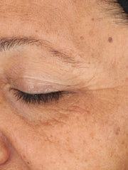 Close up of face before using product